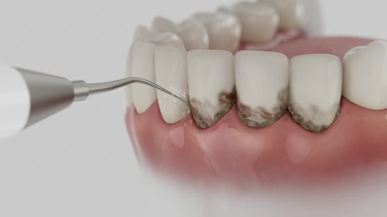 Reliable Dental Implants contractor in Monroe, NC by Smile Center Dentistry